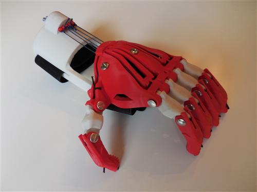 3d printed prosthetic 